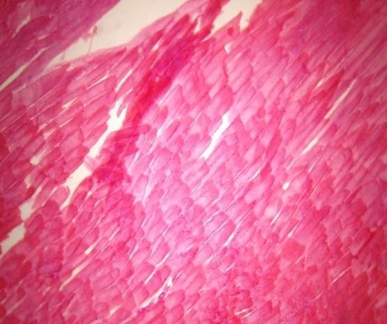 Срез мышцы после облучения на ЛСЭ, оптическая микроскопия
