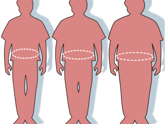 В НГУ разработают первую в России диагностическую систему, позволяющую предсказывать развитие ожирения и его осложнения В НГУ разработают первую в России диагностическую систему, позволяющую предсказывать развитие ожирения и его осложнения